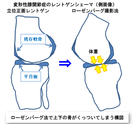 ローゼンバーグ撮影の構図