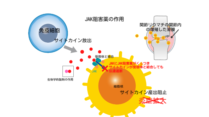 JAK 阻害剤は PsA の治療にどの程度効果がありますか?