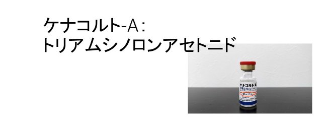 ステロイド薬 ケナコルトA