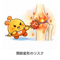 リウマチ因子　RFの見方