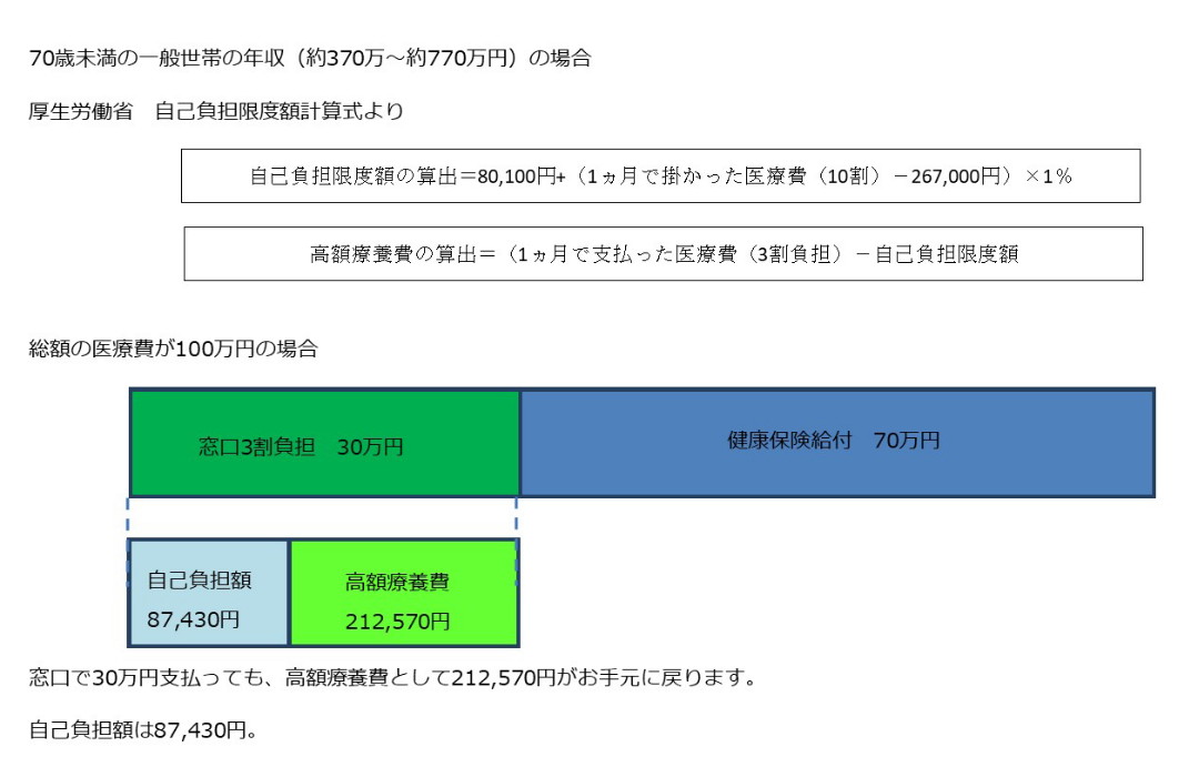 高額療養費の計算例