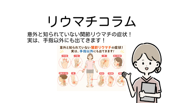 リウマチ患者さんに有益となる情報をお届けしています