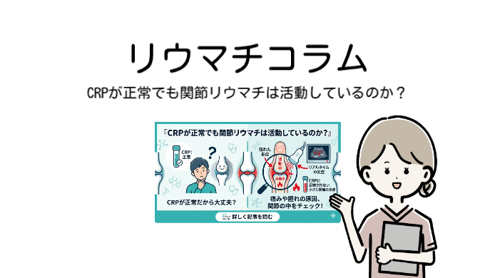 CRPが正常でも関節リウマチは活動しているのか？