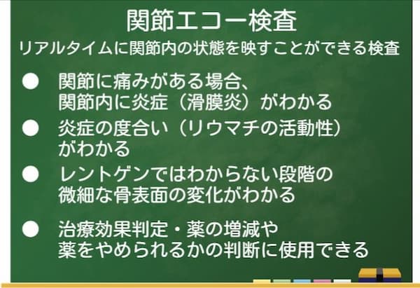 関節リウマチの超音波（エコー）検査のポイント